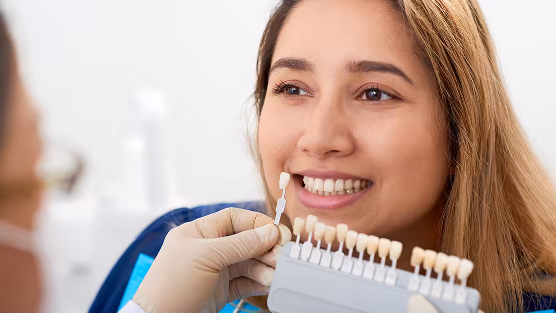 Cosmetic bonding patient shades
